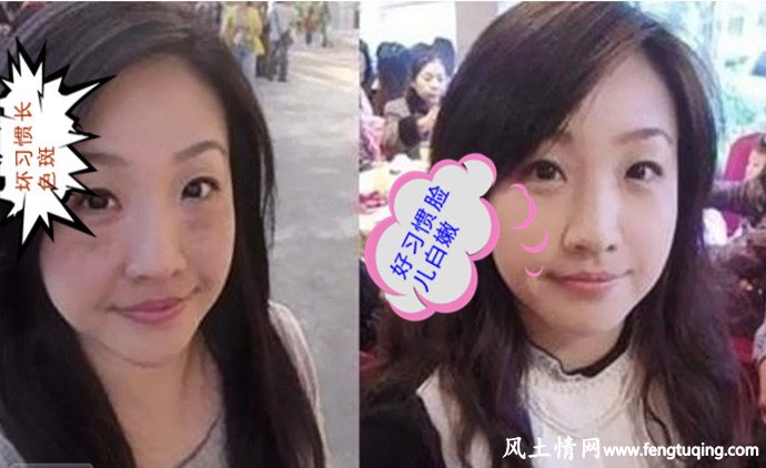 5种坏的生活习惯会助长色斑_生活习惯【风土情网】 5种坏的生活习惯会助长色斑_生活习惯【风土情网】
